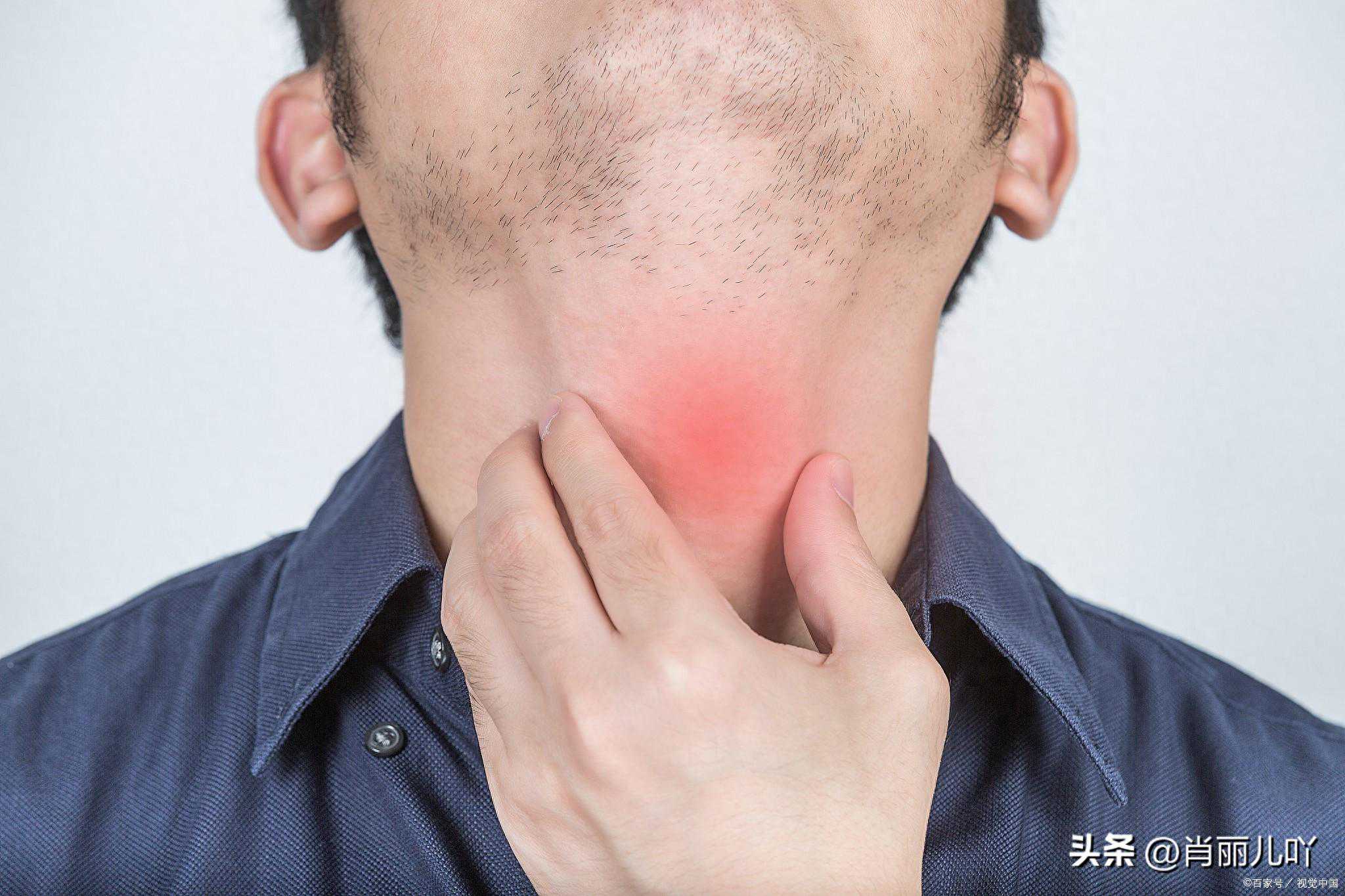 有哪些嗓子保健的方法或技巧？